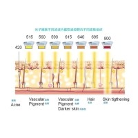 五大光子嫩肤技术（IPL、DPL、OPT、APT、BBL）及滤光片区别